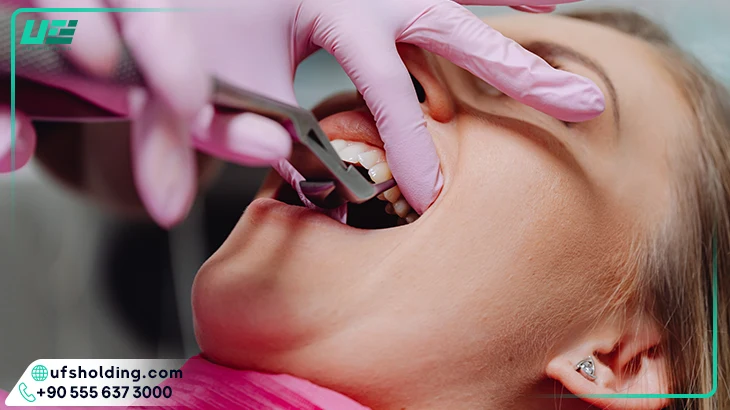 مزایای تحصیل دندانپزشکی در ترکیه